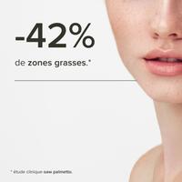 Skin Balance Peau Nette