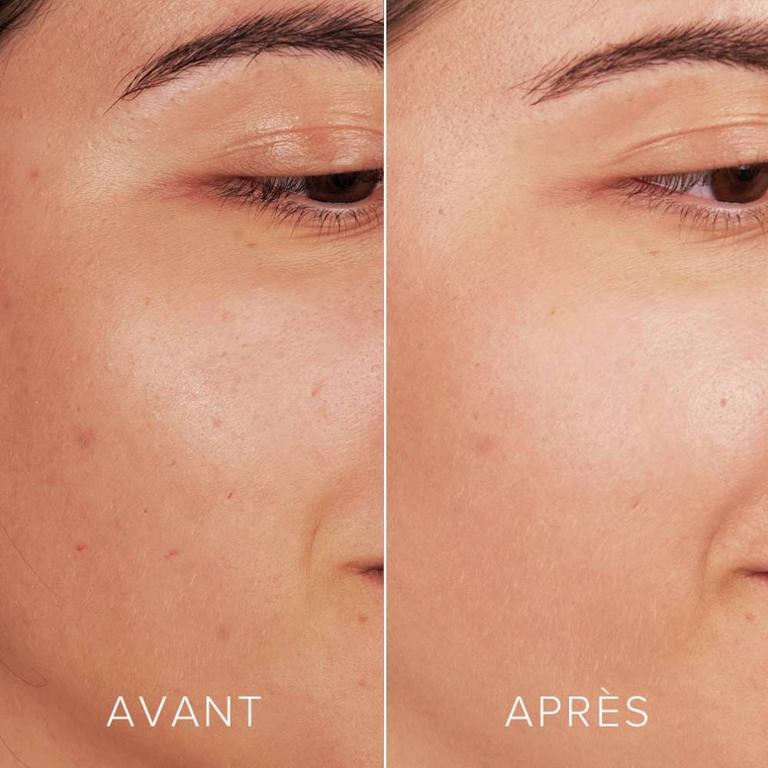 Serum à l’Acide Hyaluronique Repulpant 2,5% Bio