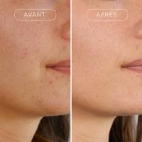 Sérum Anti-Age & Imperfections 1% Bakuchiol